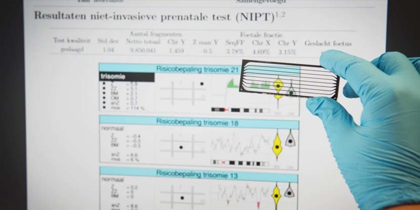 Terra Verloskundigen NIPT test Amsterdam Noord